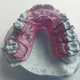 Illustration for article titled It Isnt a Good Idea to Neglect Your Teeth Due To The Fact You Do Not Have Dental Insurance